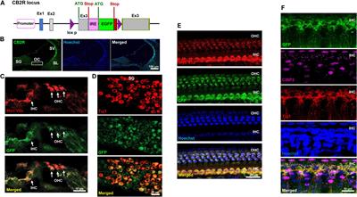 The Endocannabinoid/Cannabinoid Receptor 2 System Protects Against Cisplatin-Induced Hearing Loss